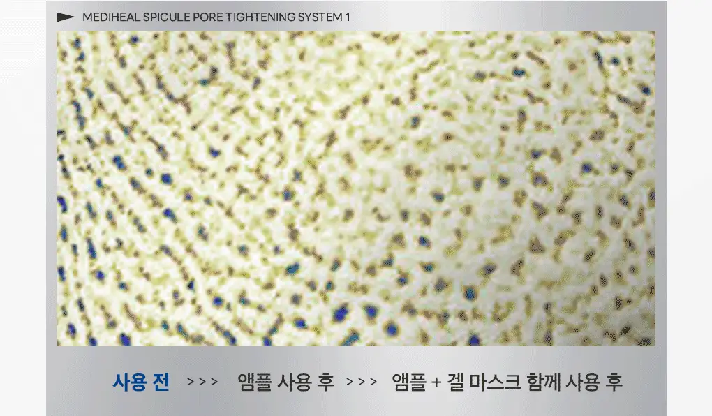 [모공부스팅/4매] 메디힐 스피큘 모공 탄력 시스템 마스크 (스피큘 1000/3000) 상세페이지 21